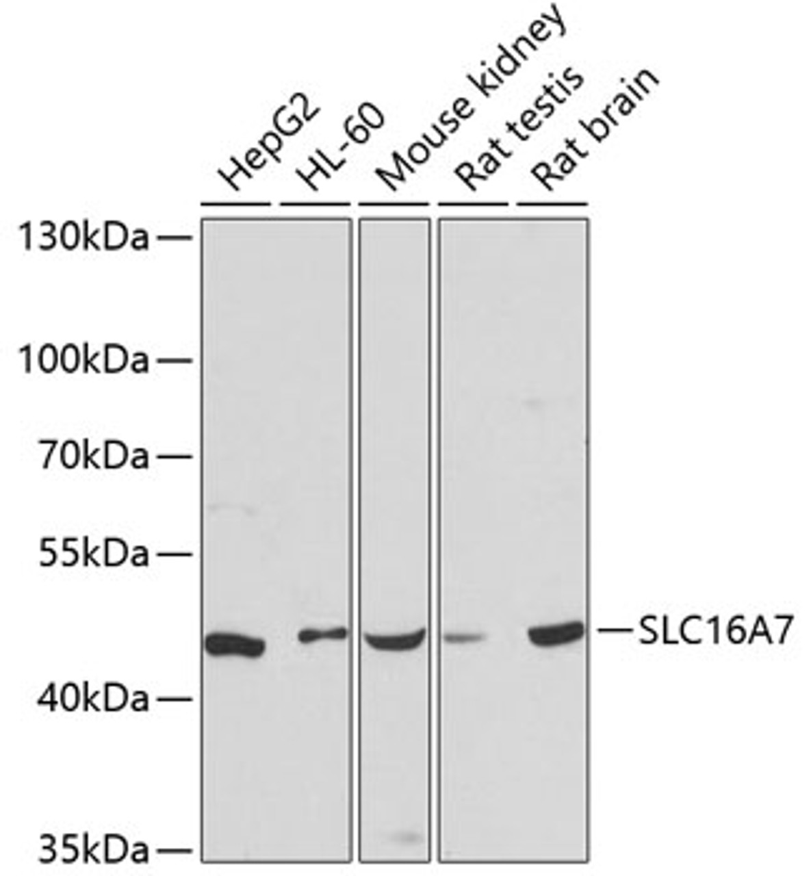 Western blot analysis of extracts of various cell lines, using SLC16A7 antibody (14-392) at 1:3000 dilution.<br/>Secondary antibody: HRP Goat Anti-Rabbit IgG (H+L) at 1:10000 dilution.<br/>Lysates/proteins: 25ug per lane.<br/>Blocking buffer: 3% nonfat dry milk in TBST.<br/>Detection: ECL Basic Kit.<br/>Exposure time: 90s.