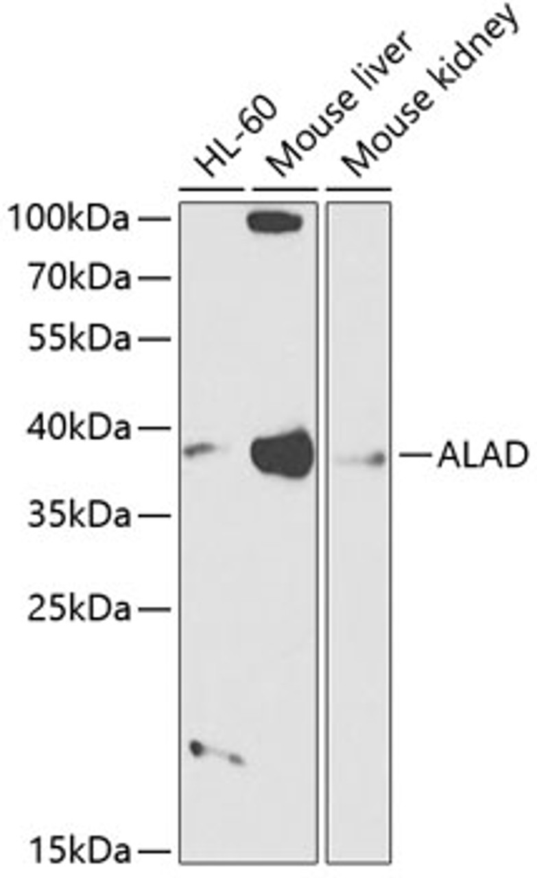 Western blot analysis of extracts of various cell lines, using ALAD antibody (14-396) at 1:1000 dilution.<br/>Secondary antibody: HRP Goat Anti-Rabbit IgG (H+L) at 1:10000 dilution.<br/>Lysates/proteins: 25ug per lane.<br/>Blocking buffer: 3% nonfat dry milk in TBST.<br/>Detection: ECL Basic Kit.<br/>Exposure time: 90s.