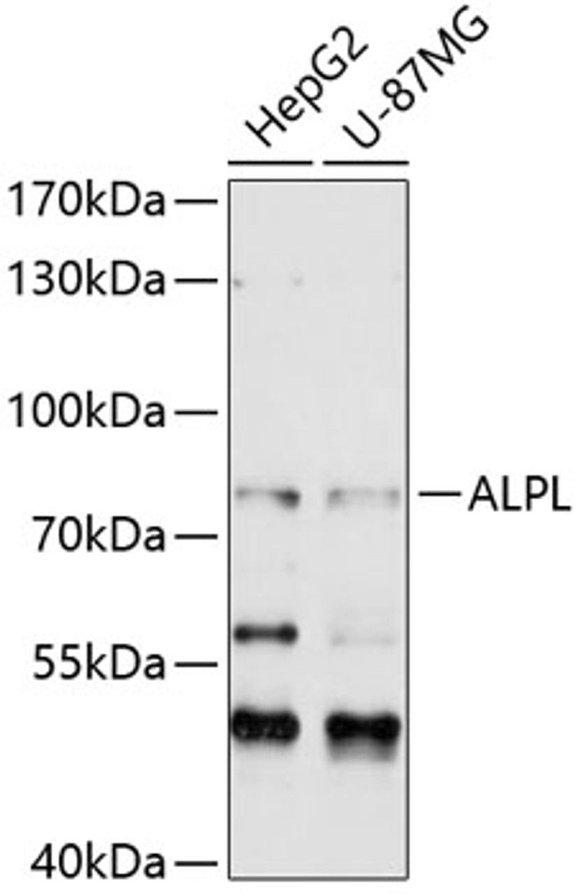 Western blot analysis of extracts of various cell lines, using ALPL antibody (14-397) at 1:1000 dilution.<br/>Secondary antibody: HRP Goat Anti-Rabbit IgG (H+L) at 1:10000 dilution.<br/>Lysates/proteins: 25ug per lane.<br/>Blocking buffer: 3% nonfat dry milk in TBST.<br/>Detection: ECL Basic Kit.<br/>Exposure time: 30s.