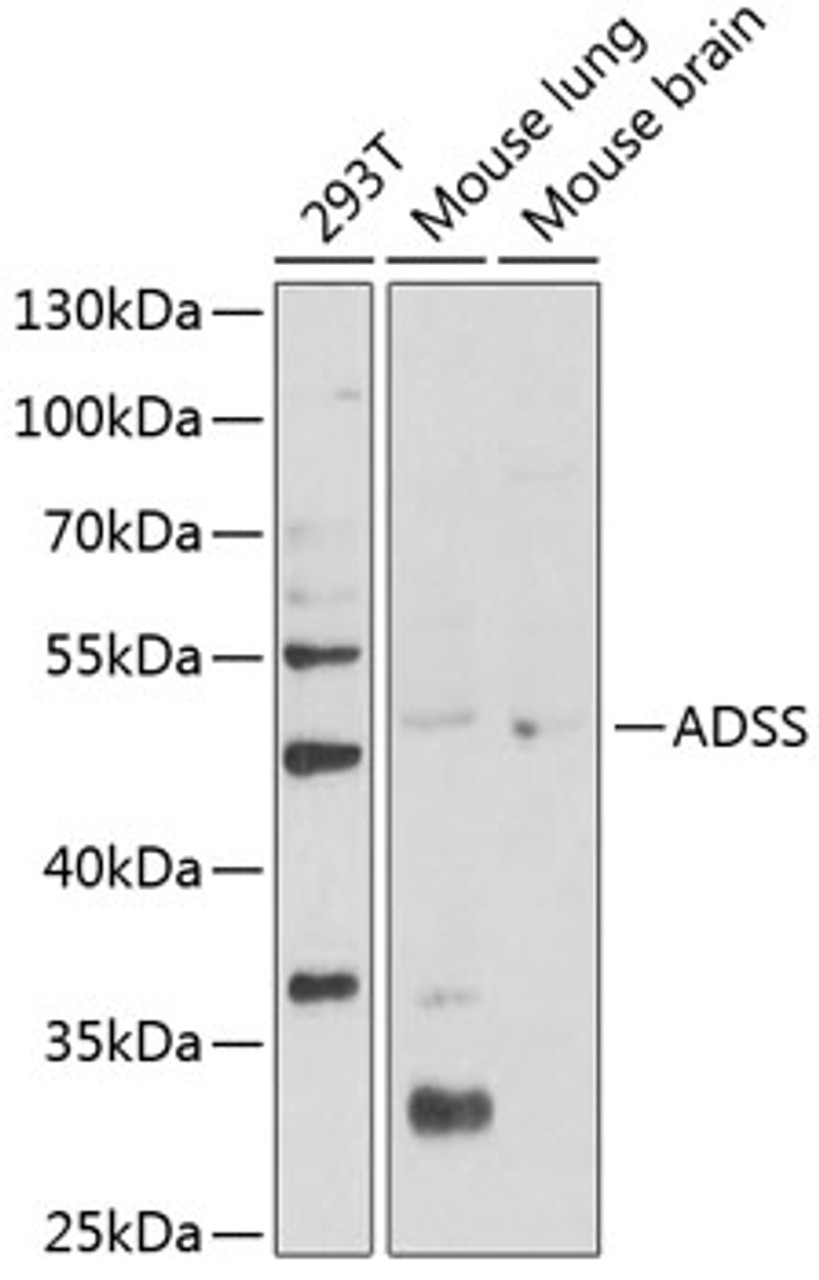 Western blot analysis of extracts of various cell lines, using ADSS Antibody (14-399) at 1:1000 dilution.<br/>Secondary antibody: HRP Goat Anti-Rabbit IgG (H+L) at 1:10000 dilution.<br/>Lysates/proteins: 25ug per lane.<br/>Blocking buffer: 3% nonfat dry milk in TBST.<br/>Detection: ECL Basic Kit.<br/>Exposure time: 90s.
