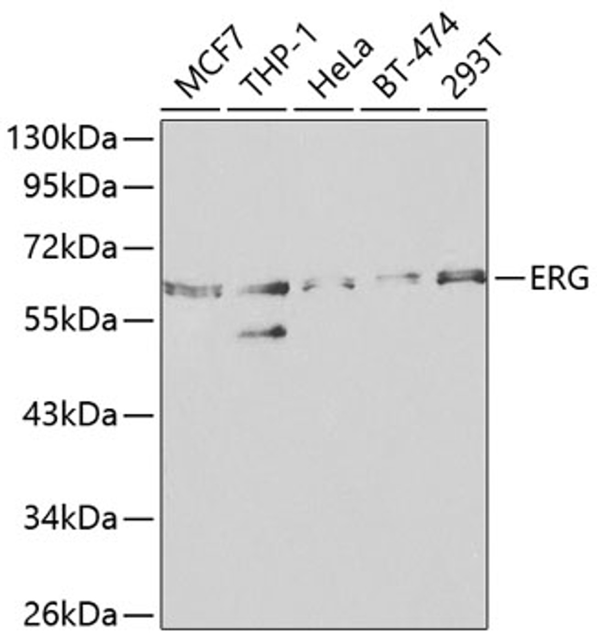 Western blot analysis of extracts of various cell lines, using ERG antibody (14-401) at 1:1000 dilution.<br/>Secondary antibody: HRP Goat Anti-Rabbit IgG (H+L) at 1:10000 dilution.<br/>Lysates/proteins: 25ug per lane.<br/>Blocking buffer: 3% nonfat dry milk in TBST.