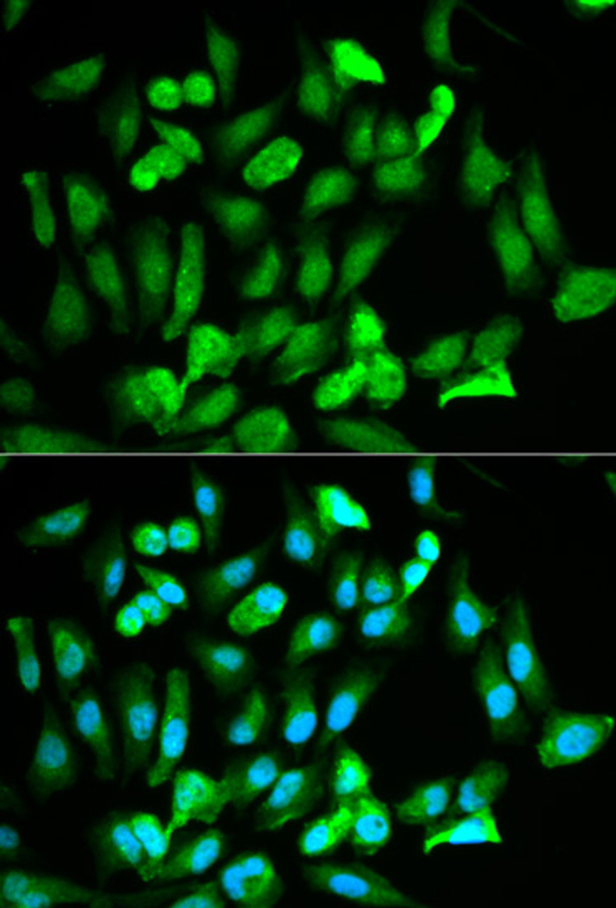 Immunofluorescence analysis of HeLa cells using ERG antibody (14-401) . Blue: DAPI for nuclear staining.