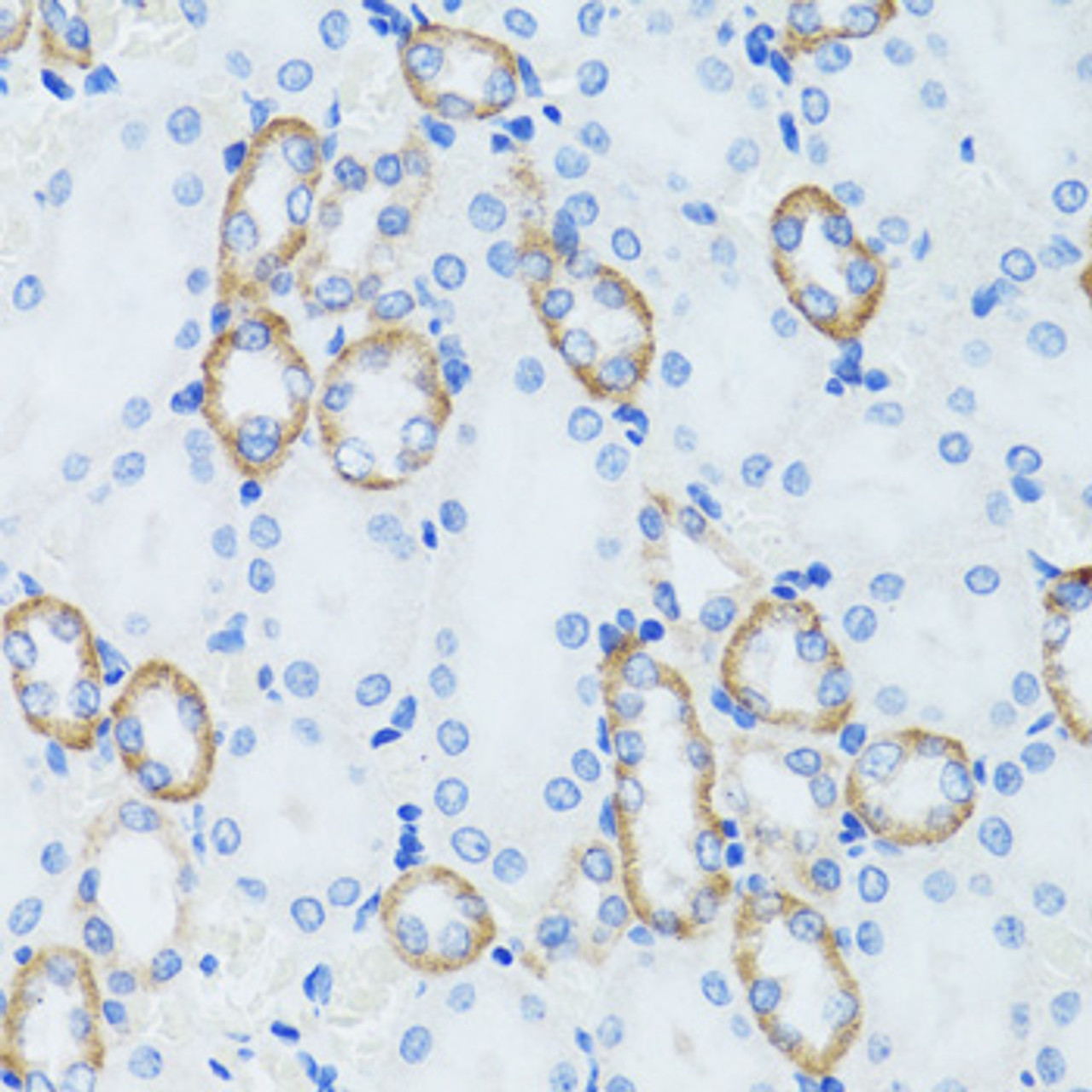 Immunohistochemistry of paraffin-embedded rat kidney using C1 Inactivator antibody (14-404) at dilution of 1:100 (40x lens) .