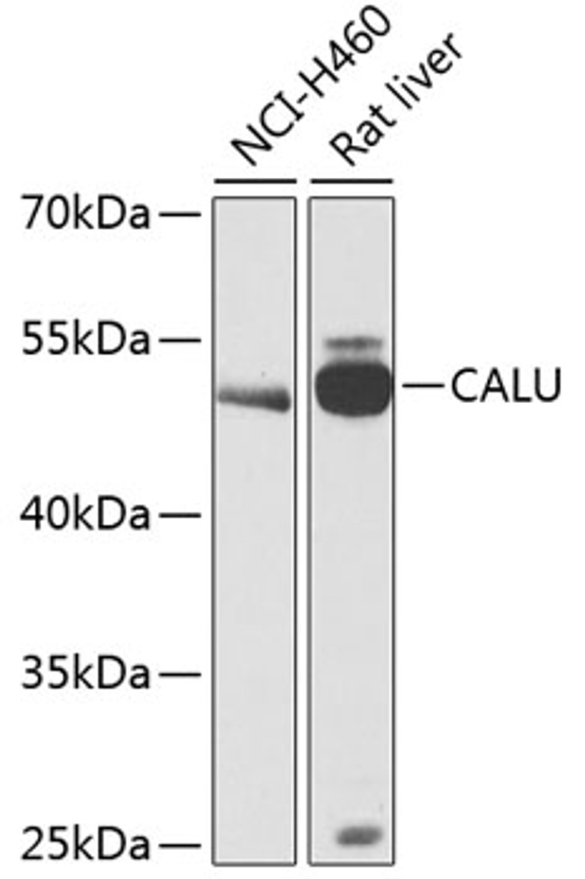 Western blot analysis of extracts of various cell lines, using CALU antibody (14-405) at 1:1000 dilution.<br/>Secondary antibody: HRP Goat Anti-Rabbit IgG (H+L) at 1:10000 dilution.<br/>Lysates/proteins: 25ug per lane.<br/>Blocking buffer: 3% nonfat dry milk in TBST.<br/>Detection: ECL Basic Kit.<br/>Exposure time: 90s.