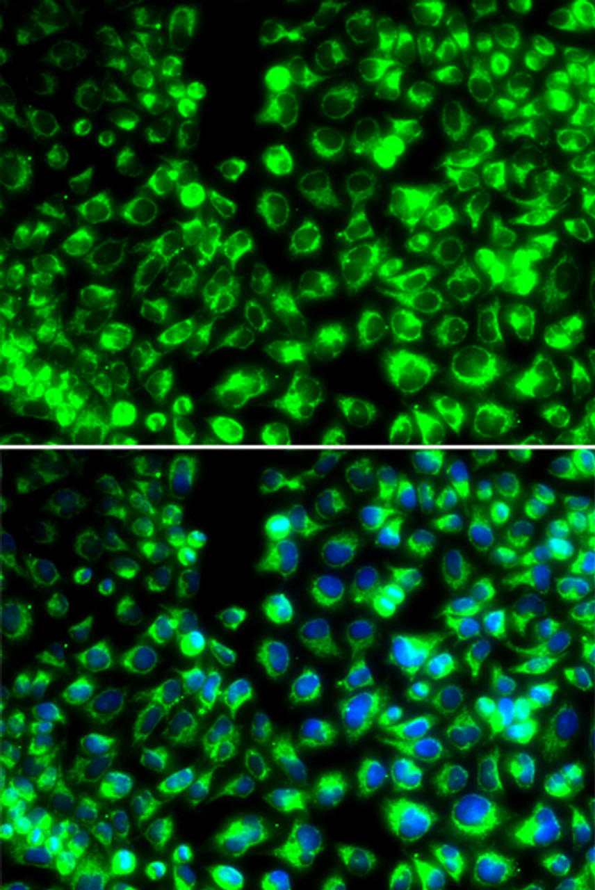 Immunofluorescence analysis of HeLa cells using CALU antibody (14-405) . Blue: DAPI for nuclear staining.