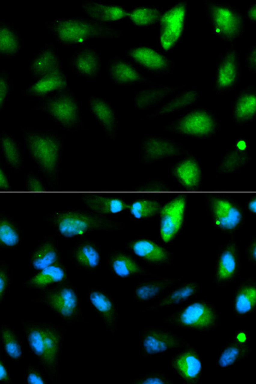 Immunofluorescence analysis of HeLa cells using F11R antibody (14-406) . Blue: DAPI for nuclear staining.