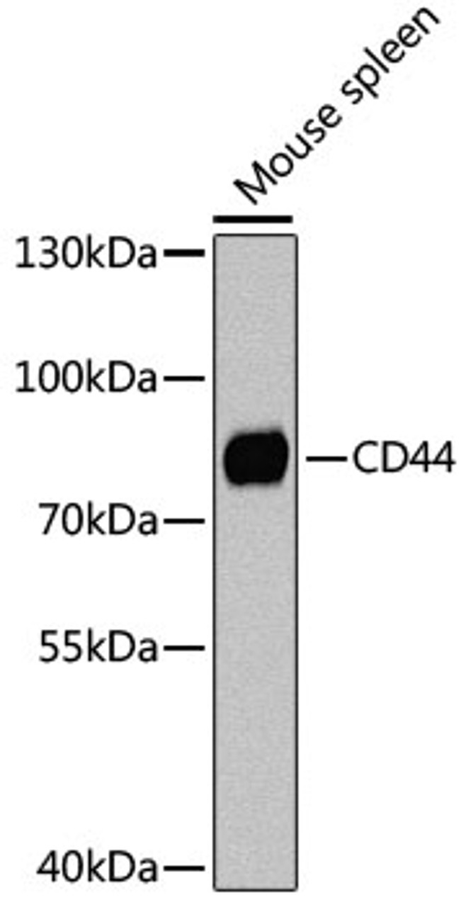 Western blot analysis of extracts of mouse spleen, using CD44 Antibody (14-407) at 1:1000 dilution.<br/>Secondary antibody: HRP Goat Anti-Rabbit IgG (H+L) at 1:10000 dilution.<br/>Lysates/proteins: 25ug per lane.<br/>Blocking buffer: 3% nonfat dry milk in TBST.<br/>Detection: ECL Basic Kit.<br/>Exposure time: 90s.