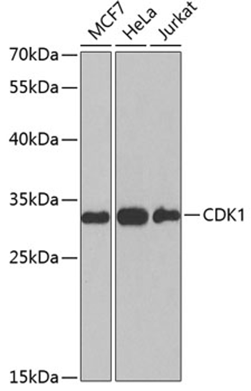 Western blot analysis of extracts of various cell lines, using CDK1 antibody (14-408) at 1:1000 dilution.<br/>Secondary antibody: HRP Goat Anti-Rabbit IgG (H+L) at 1:10000 dilution.<br/>Lysates/proteins: 25ug per lane.<br/>Blocking buffer: 3% nonfat dry milk in TBST.<br/>Detection: ECL Basic Kit.<br/>Exposure time: 30s.