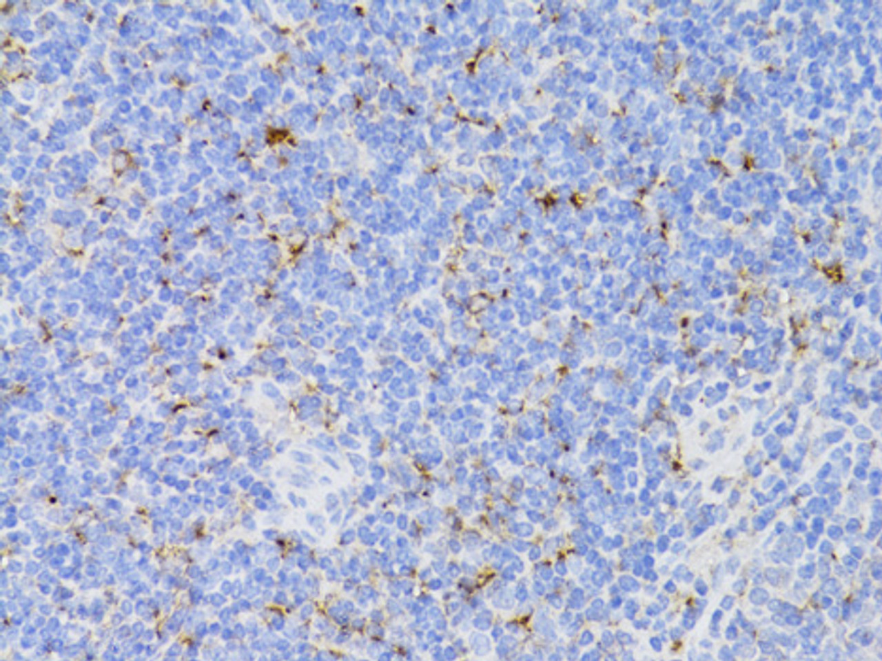 Immunohistochemistry of paraffin-embedded mouse spleen using CD3E Antigen antibody (14-409) at dilution of 1:100 (40x lens) .