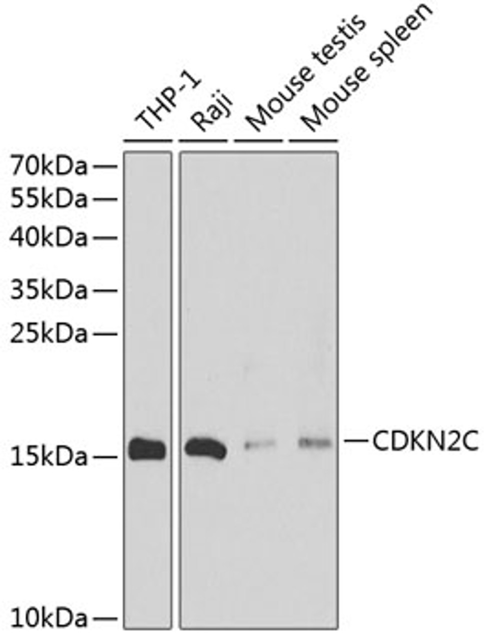 Western blot analysis of extracts of various cell lines, using CDKN2C antibody (14-410) at 1:500 dilution.<br/>Secondary antibody: HRP Goat Anti-Rabbit IgG (H+L) at 1:10000 dilution.<br/>Lysates/proteins: 25ug per lane.<br/>Blocking buffer: 3% nonfat dry milk in TBST.<br/>Detection: ECL Enhanced Kit.<br/>Exposure time: 90s.