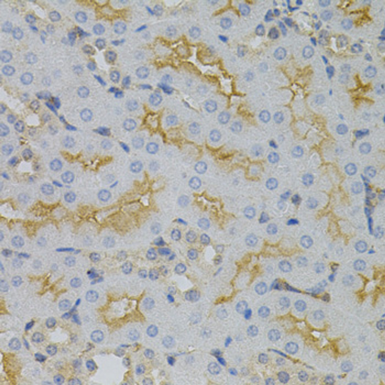Immunohistochemistry of paraffin-embedded mouse kidney using CDKN2C antibody (14-410) (40x lens) .
