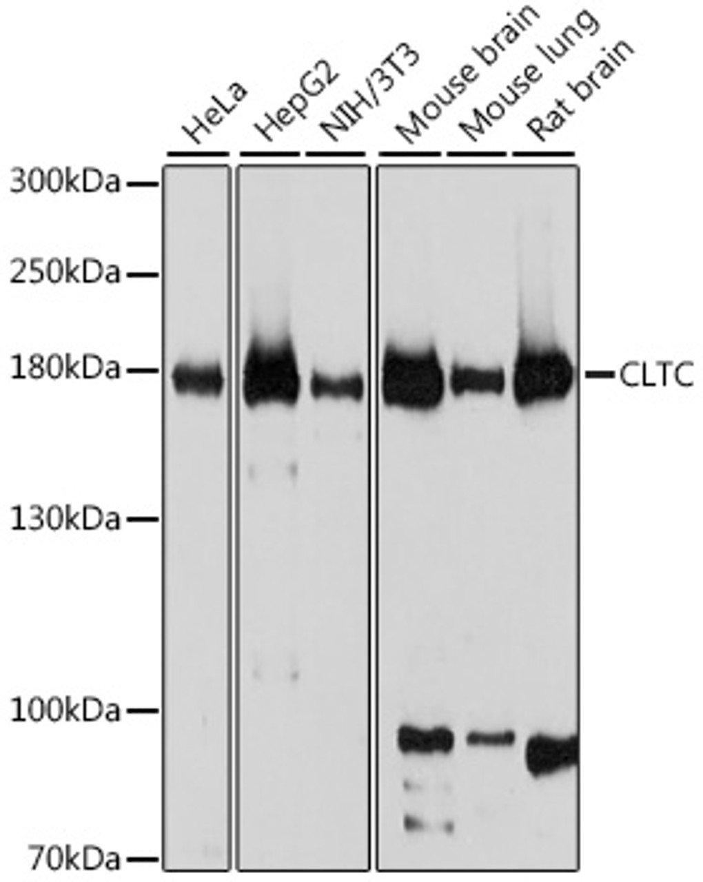 Western blot analysis of extracts of various cell lines, using CLTC antibody (14-413) at 1:1000 dilution.<br/>Secondary antibody: HRP Goat Anti-Rabbit IgG (H+L) at 1:10000 dilution.<br/>Lysates/proteins: 25ug per lane.<br/>Blocking buffer: 3% nonfat dry milk in TBST.<br/>Detection: ECL Basic Kit.<br/>Exposure time: 5s.