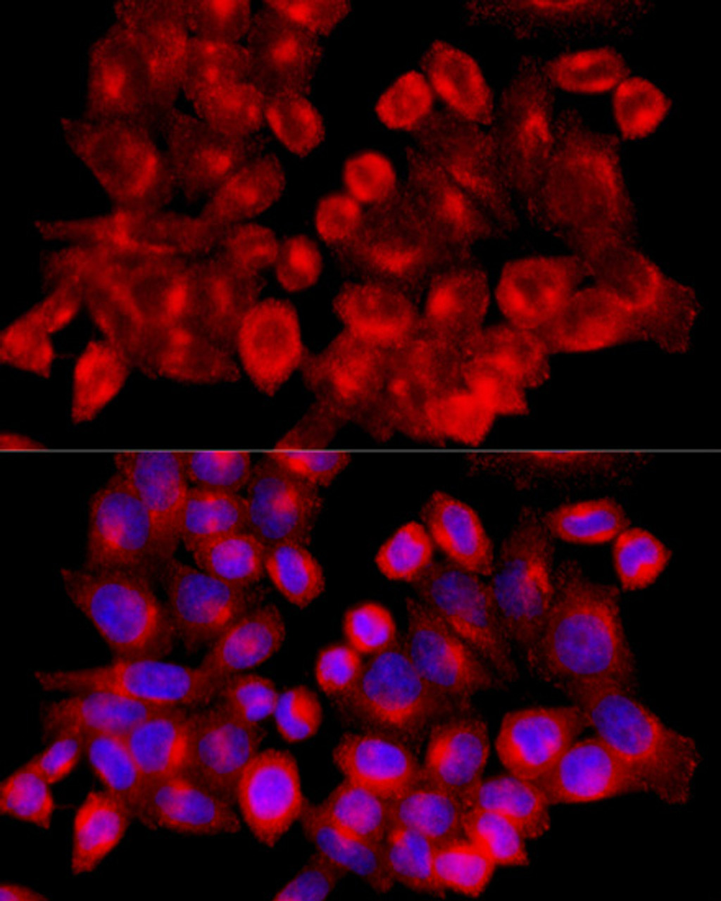 Immunofluorescence analysis of HeLa cells using CLTC antibody (14-413) at dilution of 1:100 (40x lens) . Blue: DAPI for nuclear staining.