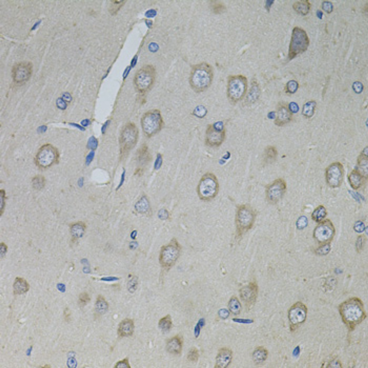 Immunohistochemistry of paraffin-embedded rat brain using CNTFR antibody (14-414) (40x lens) .
