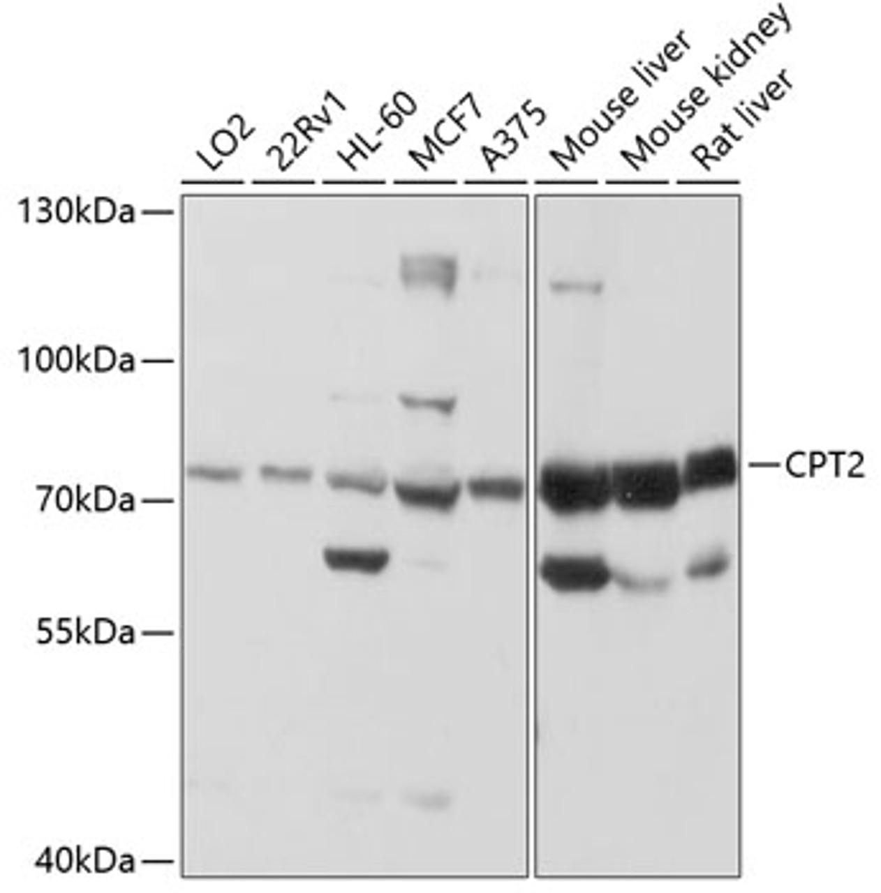 Western blot analysis of extracts of various cell lines, using CPT2 antibody (14-415) at 1:1000 dilution.<br/>Secondary antibody: HRP Goat Anti-Rabbit IgG (H+L) at 1:10000 dilution.<br/>Lysates/proteins: 25ug per lane.<br/>Blocking buffer: 3% nonfat dry milk in TBST.<br/>Detection: ECL Basic Kit.<br/>Exposure time: 1s.