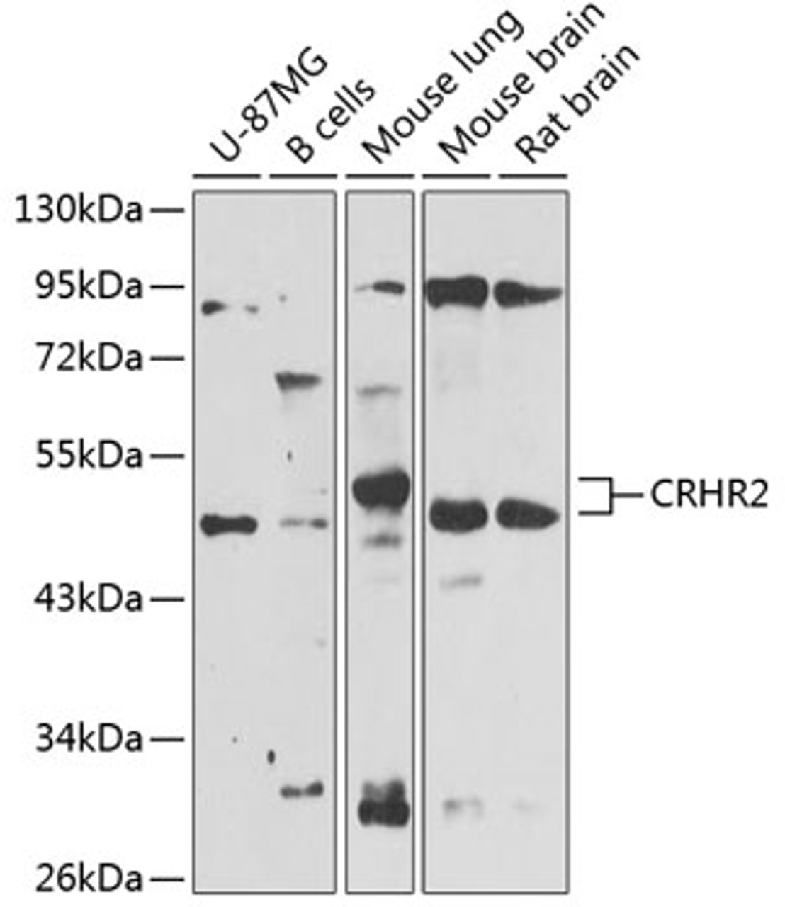 Western blot analysis of extracts of various cell lines, using CRHR2 antibody (14-416) at 1:1000 dilution.<br/>Secondary antibody: HRP Goat Anti-Rabbit IgG (H+L) at 1:10000 dilution.<br/>Lysates/proteins: 25ug per lane.<br/>Blocking buffer: 3% nonfat dry milk in TBST.<br/>Detection: ECL Enhanced Kit.<br/>Exposure time: 60s.