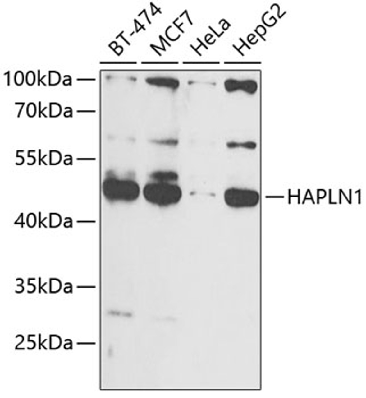 Western blot analysis of extracts of various cell lines, using HAPLN1 antibody (14-417) at 1:1000 dilution.<br/>Secondary antibody: HRP Goat Anti-Rabbit IgG (H+L) at 1:10000 dilution.<br/>Lysates/proteins: 25ug per lane.<br/>Blocking buffer: 3% nonfat dry milk in TBST.<br/>Detection: ECL Basic Kit.<br/>Exposure time: 90s.
