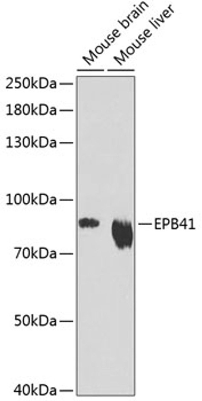 Western blot analysis of extracts of various cell lines, using EPB41 Antibody (14-420) at 1:1000 dilution.<br/>Secondary antibody: HRP Goat Anti-Rabbit IgG (H+L) at 1:10000 dilution.<br/>Lysates/proteins: 25ug per lane.<br/>Blocking buffer: 3% nonfat dry milk in TBST.<br/>Detection: ECL Enhanced Kit.