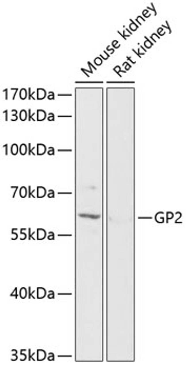 Western blot analysis of extracts of various cell lines, using GP2 antibody (14-422) at 1:1000 dilution.<br/>Secondary antibody: HRP Goat Anti-Rabbit IgG (H+L) at 1:10000 dilution.<br/>Lysates/proteins: 25ug per lane.<br/>Blocking buffer: 3% nonfat dry milk in TBST.<br/>Detection: ECL Enhanced Kit.<br/>Exposure time: 90s.