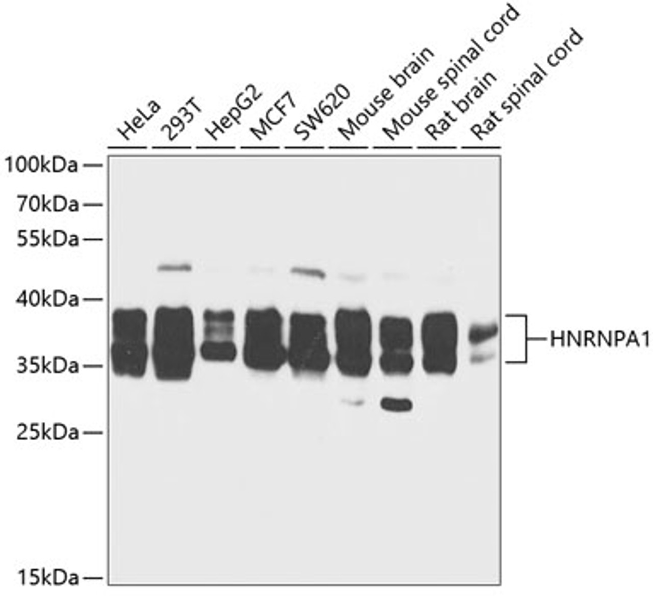 Western blot analysis of extracts of various cell lines, using HNRNPA1 antibody (14-427) at 1:1000 dilution.<br/>Secondary antibody: HRP Goat Anti-Rabbit IgG (H+L) at 1:10000 dilution.<br/>Lysates/proteins: 25ug per lane.<br/>Blocking buffer: 3% nonfat dry milk in TBST.<br/>Detection: ECL Basic Kit.<br/>Exposure time: 30s.
