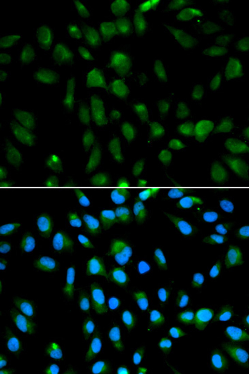 Immunofluorescence analysis of MCF-7 cells using PSMA3 antibody (14-431) . Blue: DAPI for nuclear staining.