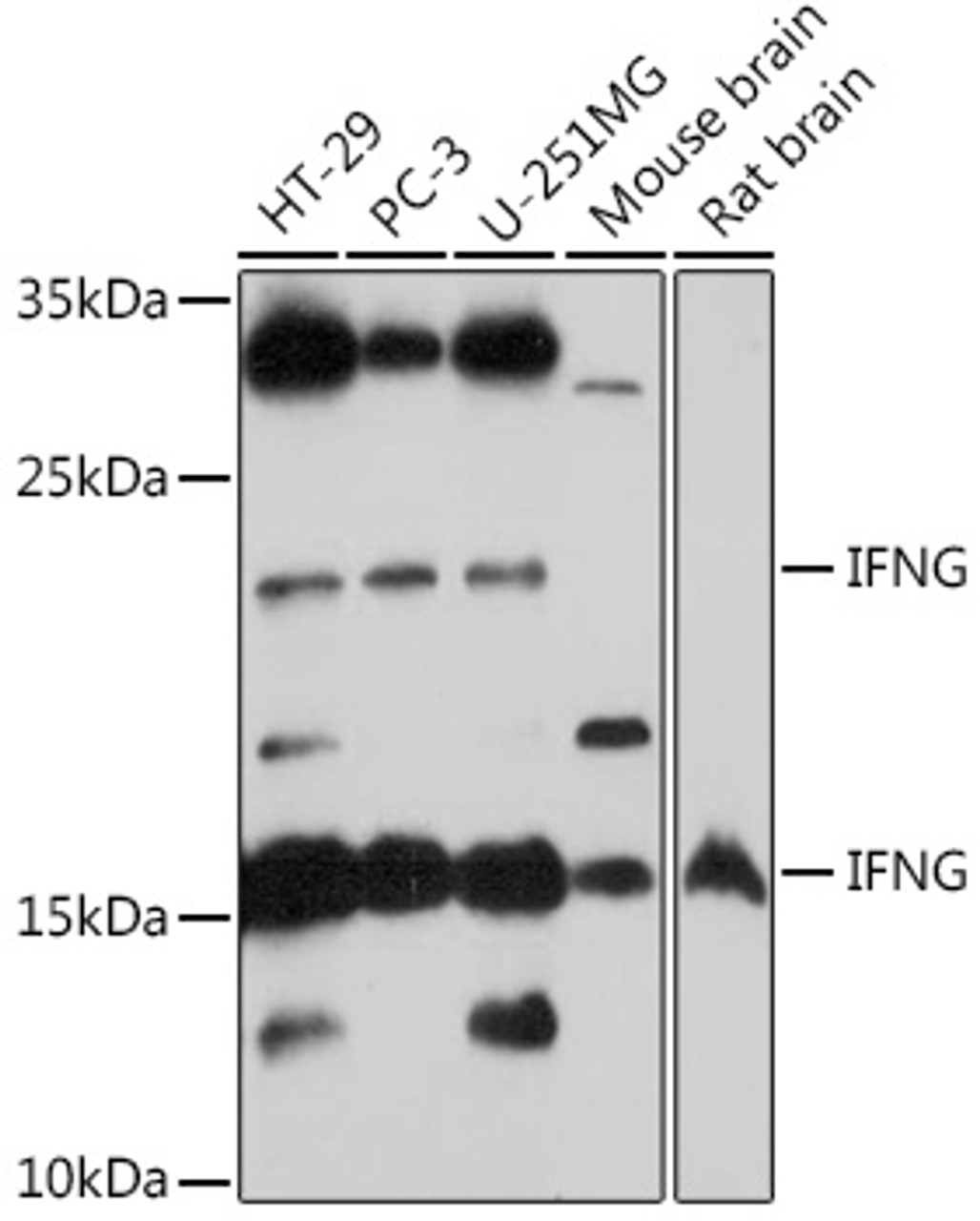 Western blot analysis of extracts of various cell lines, using IFNG antibody (14-432) at 1:1000 dilution.<br/>Secondary antibody: HRP Goat Anti-Rabbit IgG (H+L) at 1:10000 dilution.<br/>Lysates/proteins: 25ug per lane.<br/>Blocking buffer: 3% nonfat dry milk in TBST.<br/>Detection: ECL Basic Kit.<br/>Exposure time: 30s.