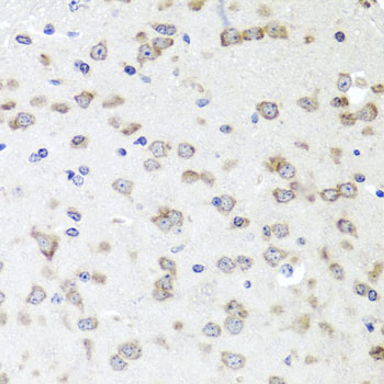 Immunohistochemistry of paraffin-embedded mouse brain using IGFBP5 antibody (14-433) at dilution of 1:100 (40x lens) .