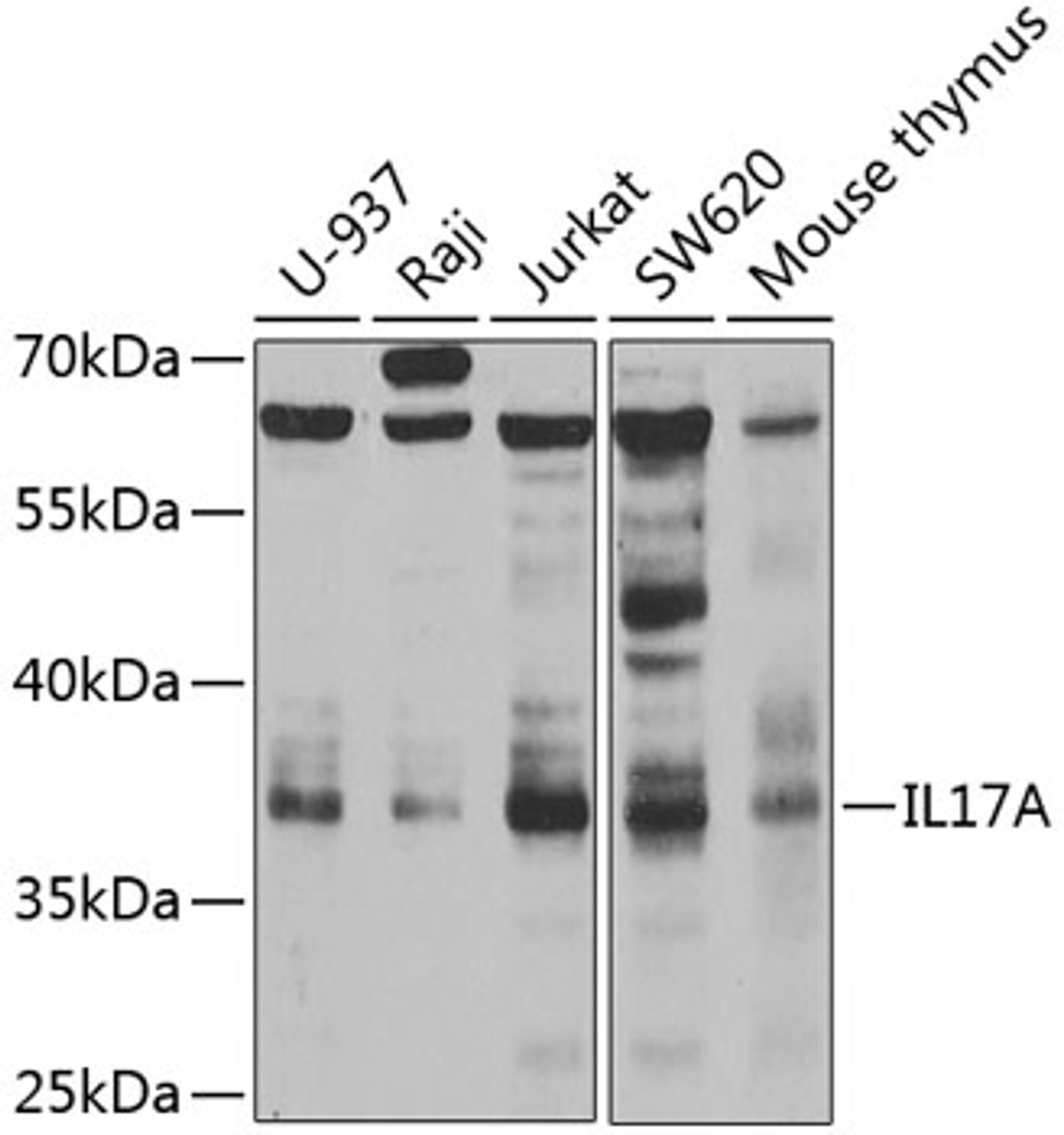Western blot analysis of extracts of various cell lines, using IL17A antibody (14-434) at 1:1000 dilution.<br/>Secondary antibody: HRP Goat Anti-Rabbit IgG (H+L) at 1:10000 dilution.<br/>Lysates/proteins: 25ug per lane.<br/>Blocking buffer: 3% nonfat dry milk in TBST.<br/>Detection: ECL Enhanced Kit.<br/>Exposure time: 30s.