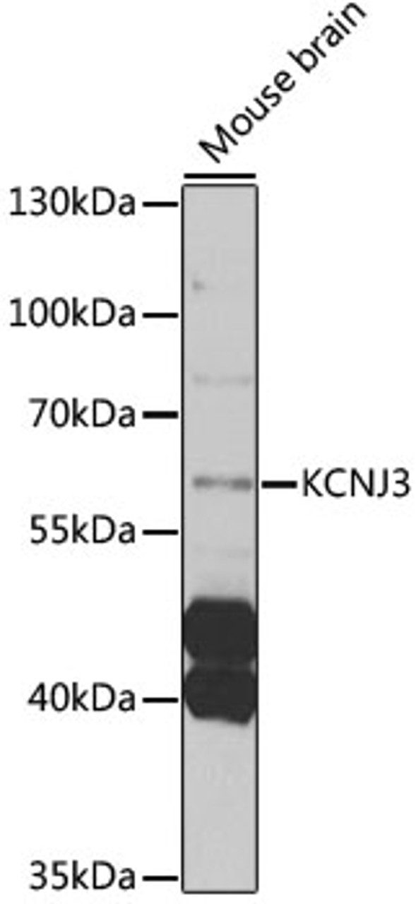 Western blot analysis of extracts of mouse brain, using KCNJ3 antibody (14-435) at 1:1000 dilution.<br/>Secondary antibody: HRP Goat Anti-Rabbit IgG (H+L) at 1:10000 dilution.<br/>Lysates/proteins: 25ug per lane.<br/>Blocking buffer: 3% nonfat dry milk in TBST.<br/>Detection: ECL Enhanced Kit.<br/>Exposure time: 10s.