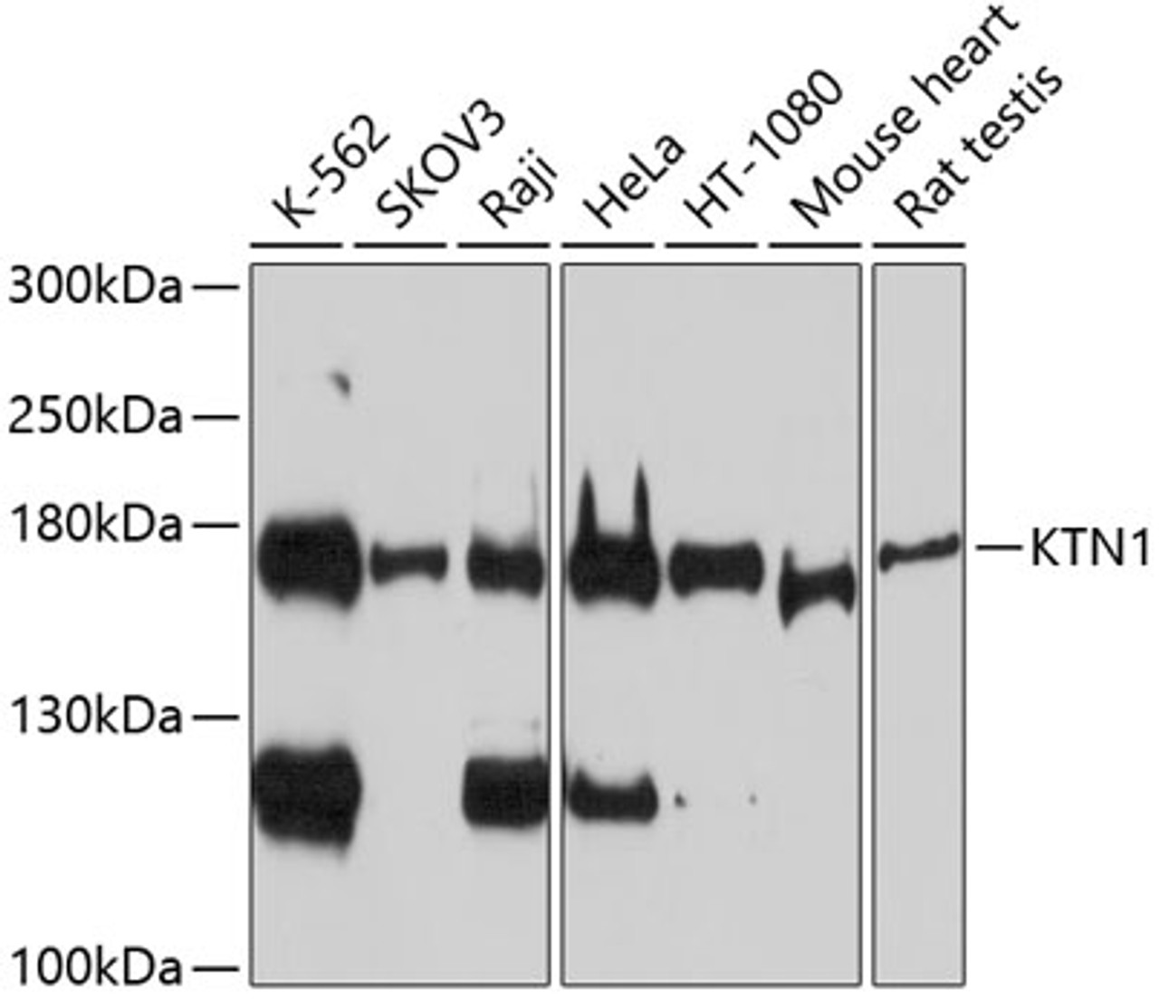 Western blot analysis of extracts of various cell lines, using KTN1 antibody (14-436) at 1:1000 dilution.<br/>Secondary antibody: HRP Goat Anti-Rabbit IgG (H+L) at 1:10000 dilution.<br/>Lysates/proteins: 25ug per lane.<br/>Blocking buffer: 3% nonfat dry milk in TBST.<br/>Detection: ECL Basic Kit.<br/>Exposure time: 90s.