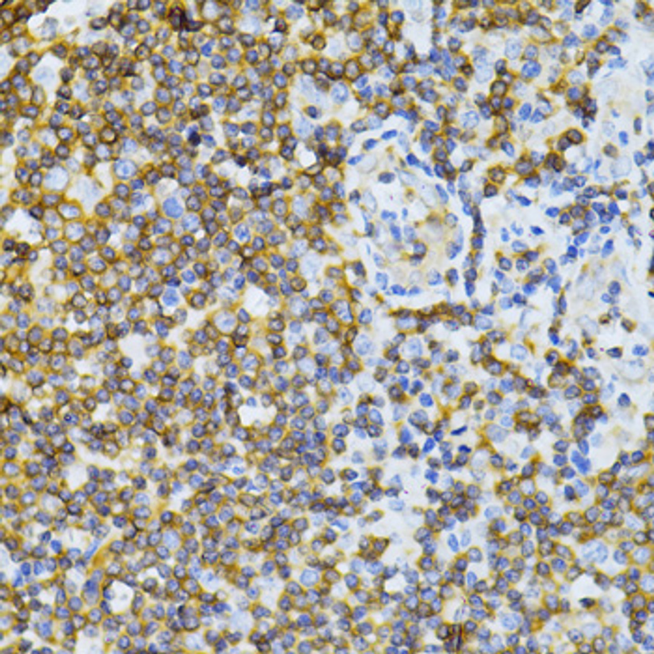 Immunohistochemistry of paraffin-embedded human tonsil using MT-ND5 antibody (14-438) at dilution of 1:100 (40x lens) .