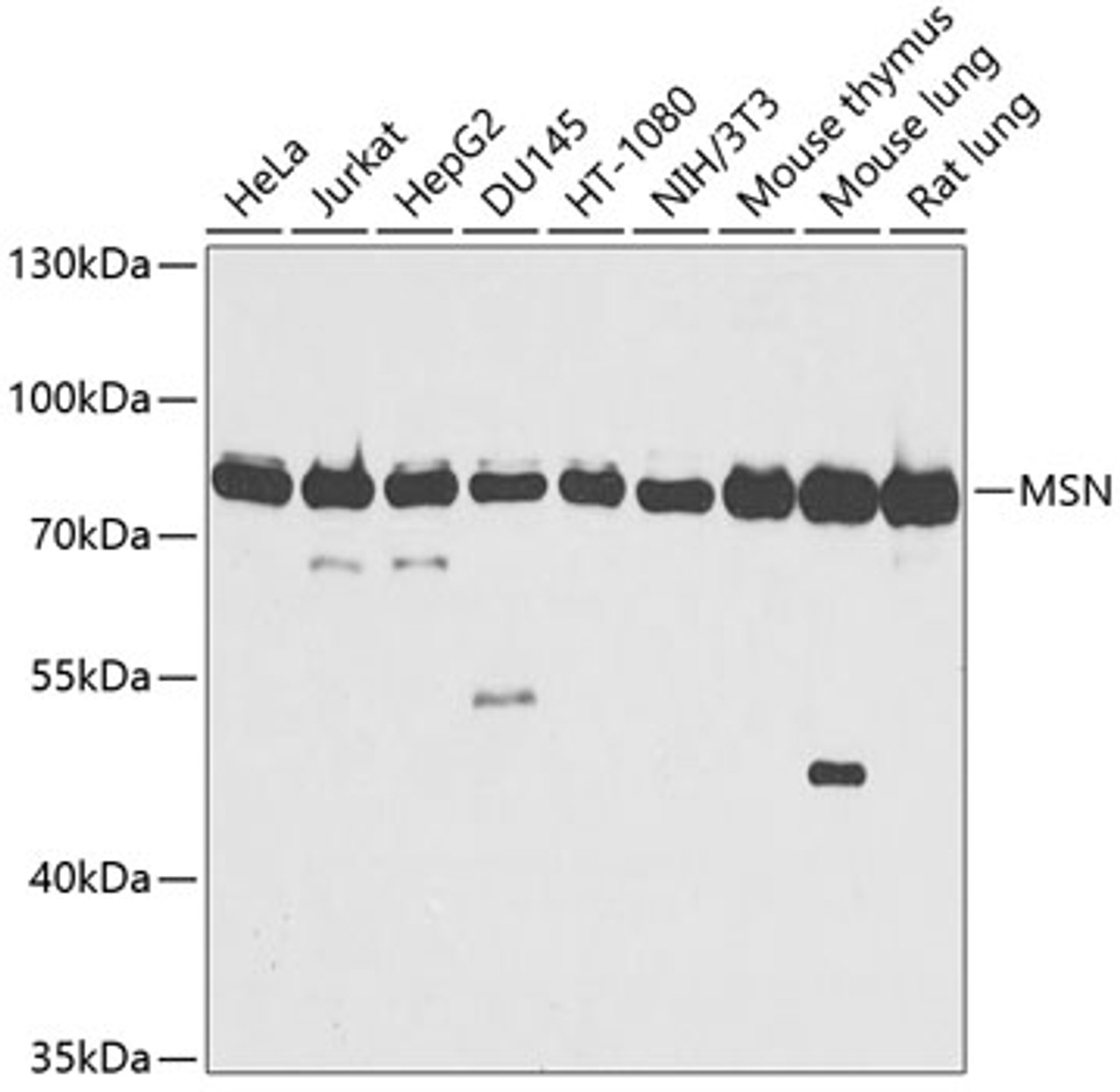 Western blot analysis of extracts of various cell lines, using MSN antibody (14-444) at 1:1000 dilution.<br/>Secondary antibody: HRP Goat Anti-Rabbit IgG (H+L) at 1:10000 dilution.<br/>Lysates/proteins: 25ug per lane.<br/>Blocking buffer: 3% nonfat dry milk in TBST.<br/>Detection: ECL Basic Kit.<br/>Exposure time: 5s.
