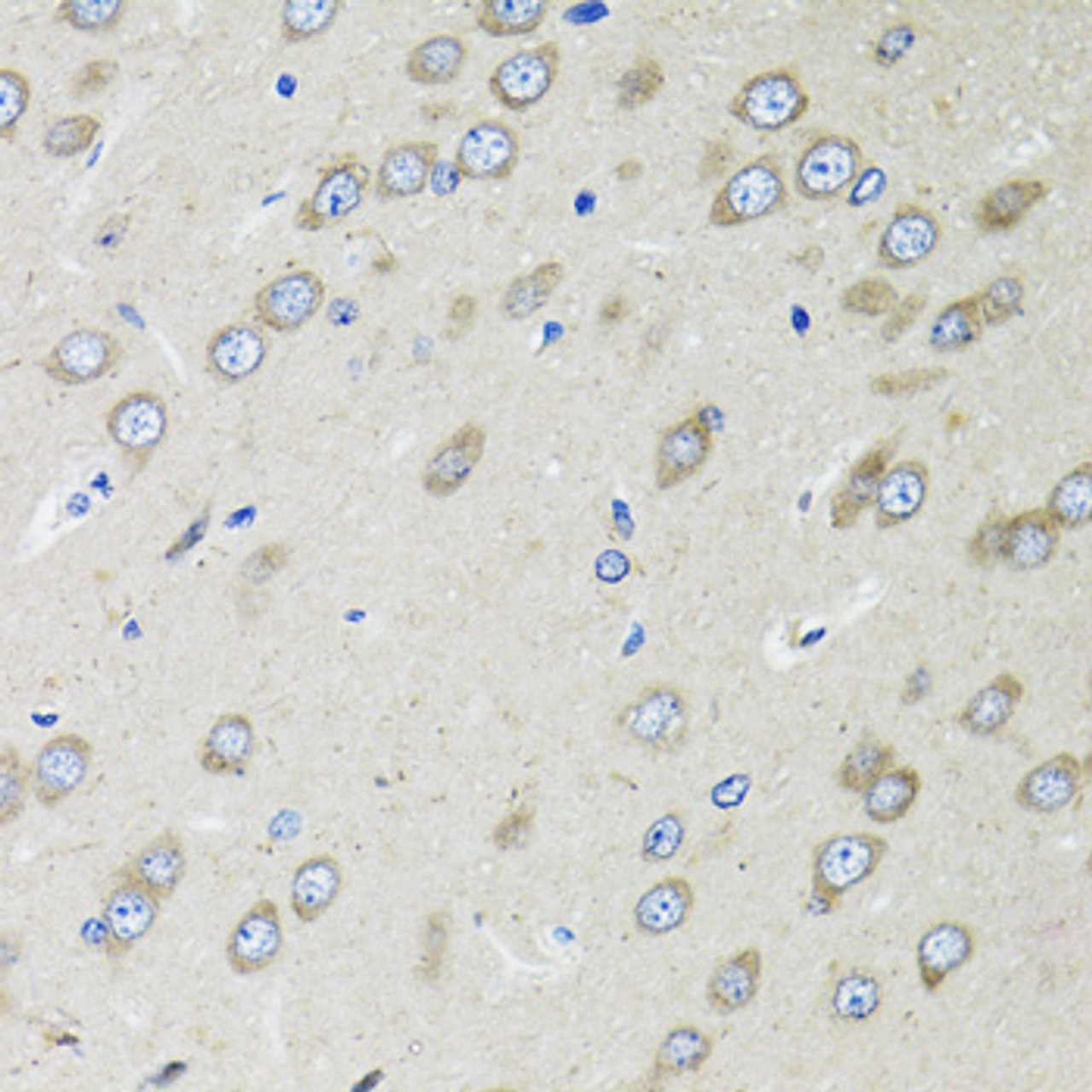 Immunohistochemistry of paraffin-embedded rat brain using OGDH antibody (14-447) at dilution of 1:100 (40x lens) .