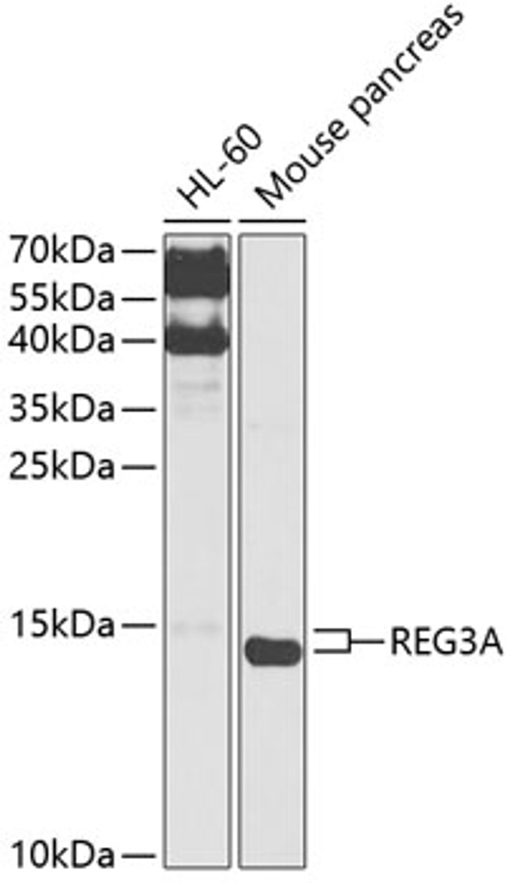 Western blot analysis of extracts of various cell lines, using REG3A antibody (14-449) at 1:1000 dilution.<br/>Secondary antibody: HRP Goat Anti-Rabbit IgG (H+L) at 1:10000 dilution.<br/>Lysates/proteins: 25ug per lane.<br/>Blocking buffer: 3% nonfat dry milk in TBST.<br/>Detection: ECL Basic Kit.<br/>Exposure time: 30s.