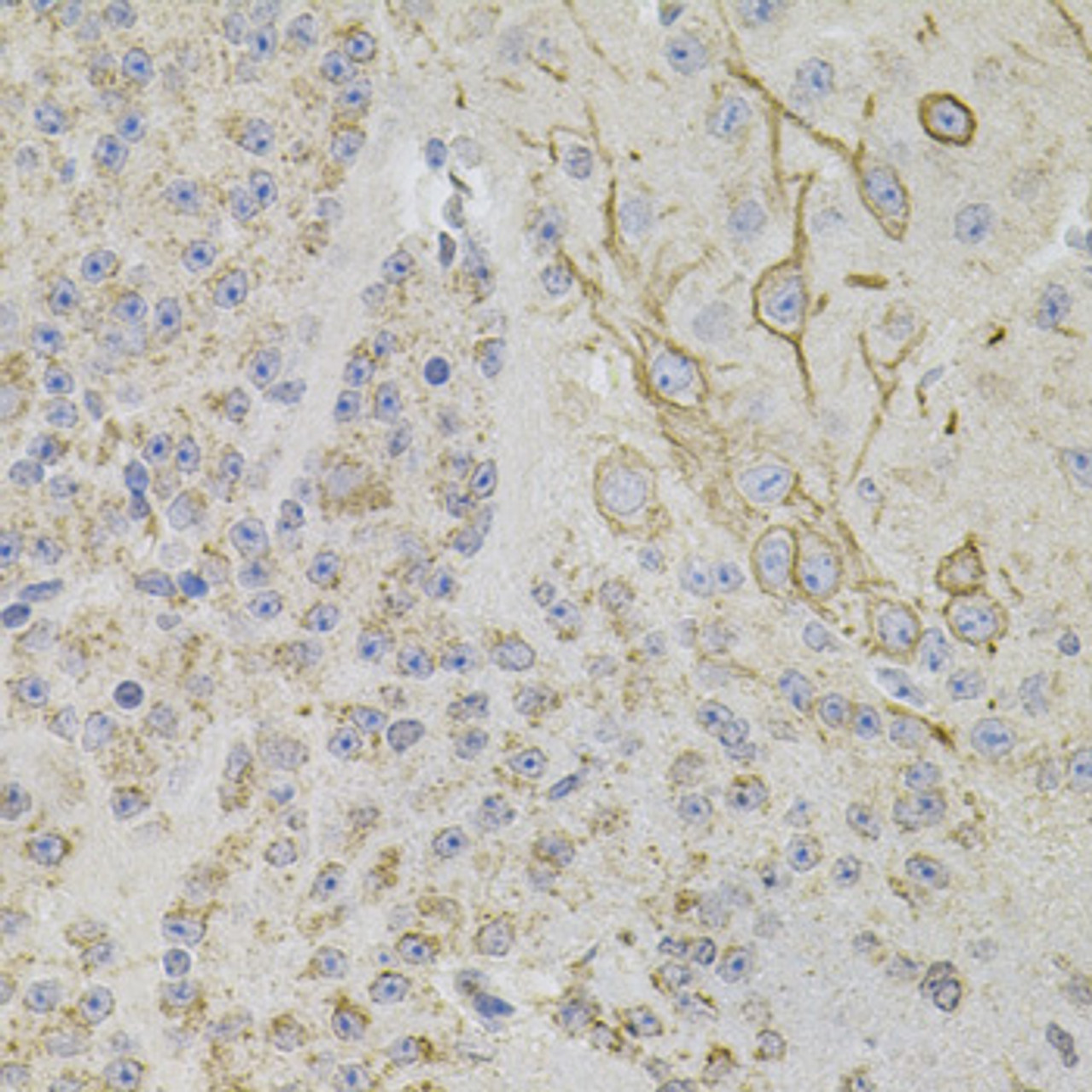 Immunohistochemistry of paraffin-embedded mouse brain using REG3A antibody (14-449) (40x lens) .