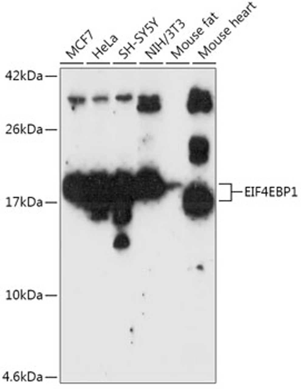 Western blot analysis of extracts of various cell lines, using EIF4EBP1 antibody (14-450) at 1:1000 dilution.<br/>Secondary antibody: HRP Goat Anti-Rabbit IgG (H+L) at 1:10000 dilution.<br/>Lysates/proteins: 25ug per lane.<br/>Blocking buffer: 3% nonfat dry milk in TBST.<br/>Detection: ECL Basic Kit.<br/>Exposure time: 60s.