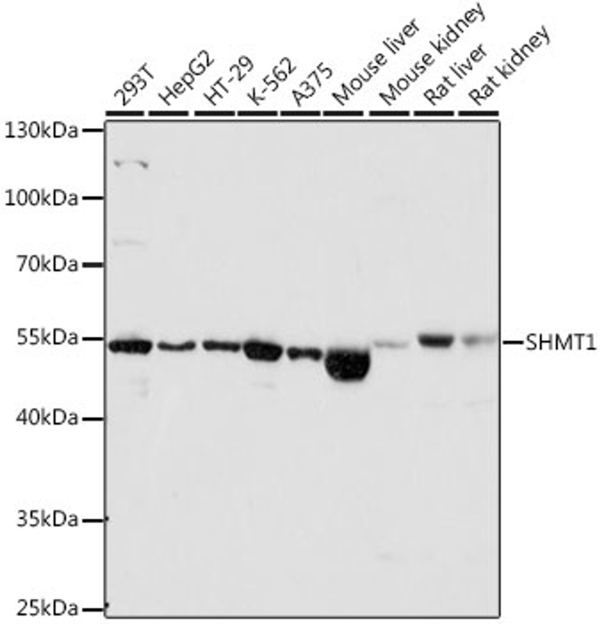 Western blot analysis of extracts of various cell lines, using SHMT1 antibody (14-456) at 1:1000 dilution.<br/>Secondary antibody: HRP Goat Anti-Rabbit IgG (H+L) at 1:10000 dilution.<br/>Lysates/proteins: 25ug per lane.<br/>Blocking buffer: 3% nonfat dry milk in TBST.<br/>Detection: ECL Basic Kit.<br/>Exposure time: 10s.