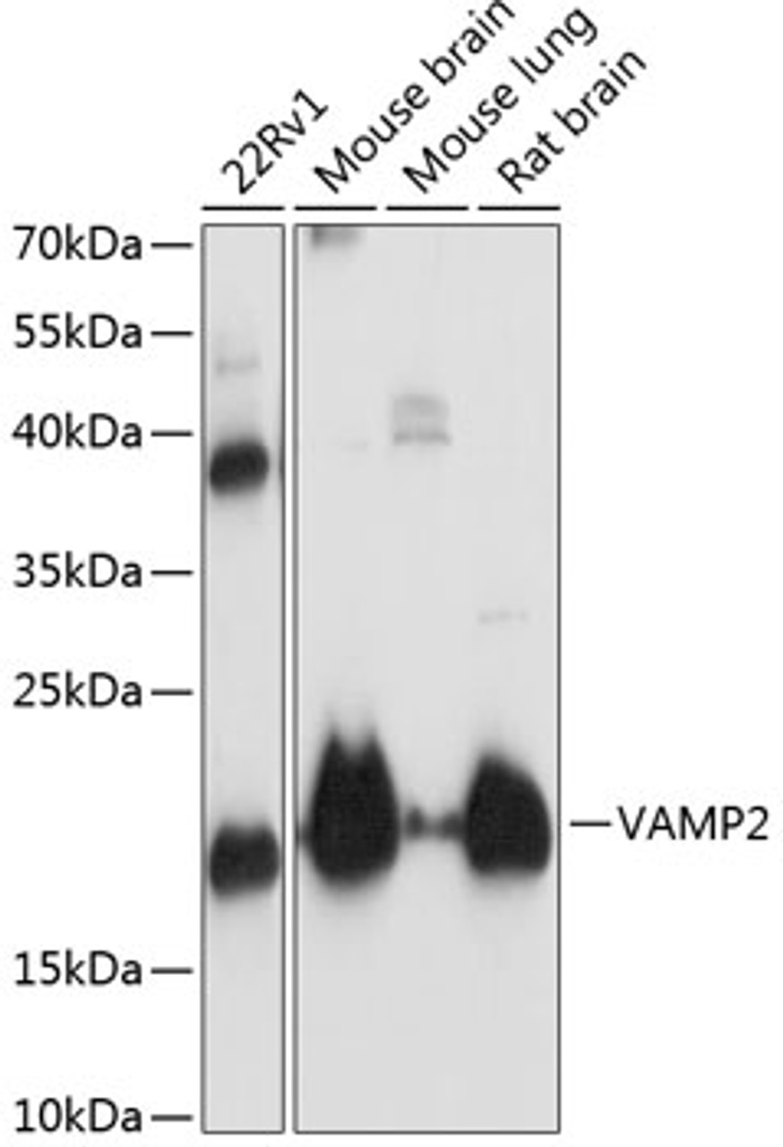 Western blot analysis of extracts of various cell lines, using VAMP2 antibody (14-457) at 1:3000 dilution.<br/>Secondary antibody: HRP Goat Anti-Rabbit IgG (H+L) at 1:10000 dilution.<br/>Lysates/proteins: 25ug per lane.<br/>Blocking buffer: 3% nonfat dry milk in TBST.<br/>Detection: ECL Basic Kit.<br/>Exposure time: 10s.