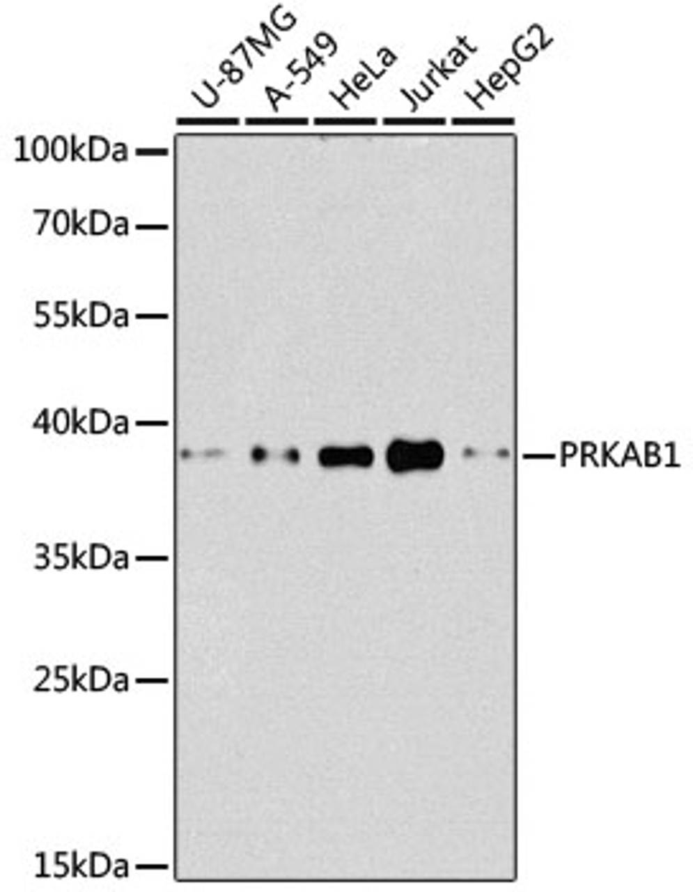 Western blot analysis of extracts of various cell lines, using PRKAB1 antibody (14-458) at 1:1000 dilution.<br/>Secondary antibody: HRP Goat Anti-Rabbit IgG (H+L) at 1:10000 dilution.<br/>Lysates/proteins: 25ug per lane.<br/>Blocking buffer: 3% nonfat dry milk in TBST.<br/>Detection: ECL Basic Kit.<br/>Exposure time: 90s.