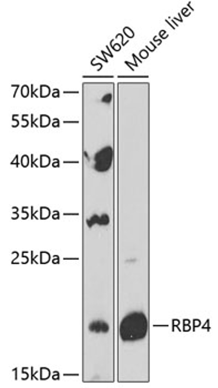 Western blot analysis of extracts of various cell lines, using RBP4 Antibody (14-460) at 1:1000 dilution.<br/>Secondary antibody: HRP Goat Anti-Rabbit IgG (H+L) at 1:10000 dilution.<br/>Lysates/proteins: 25ug per lane.<br/>Blocking buffer: 3% nonfat dry milk in TBST.