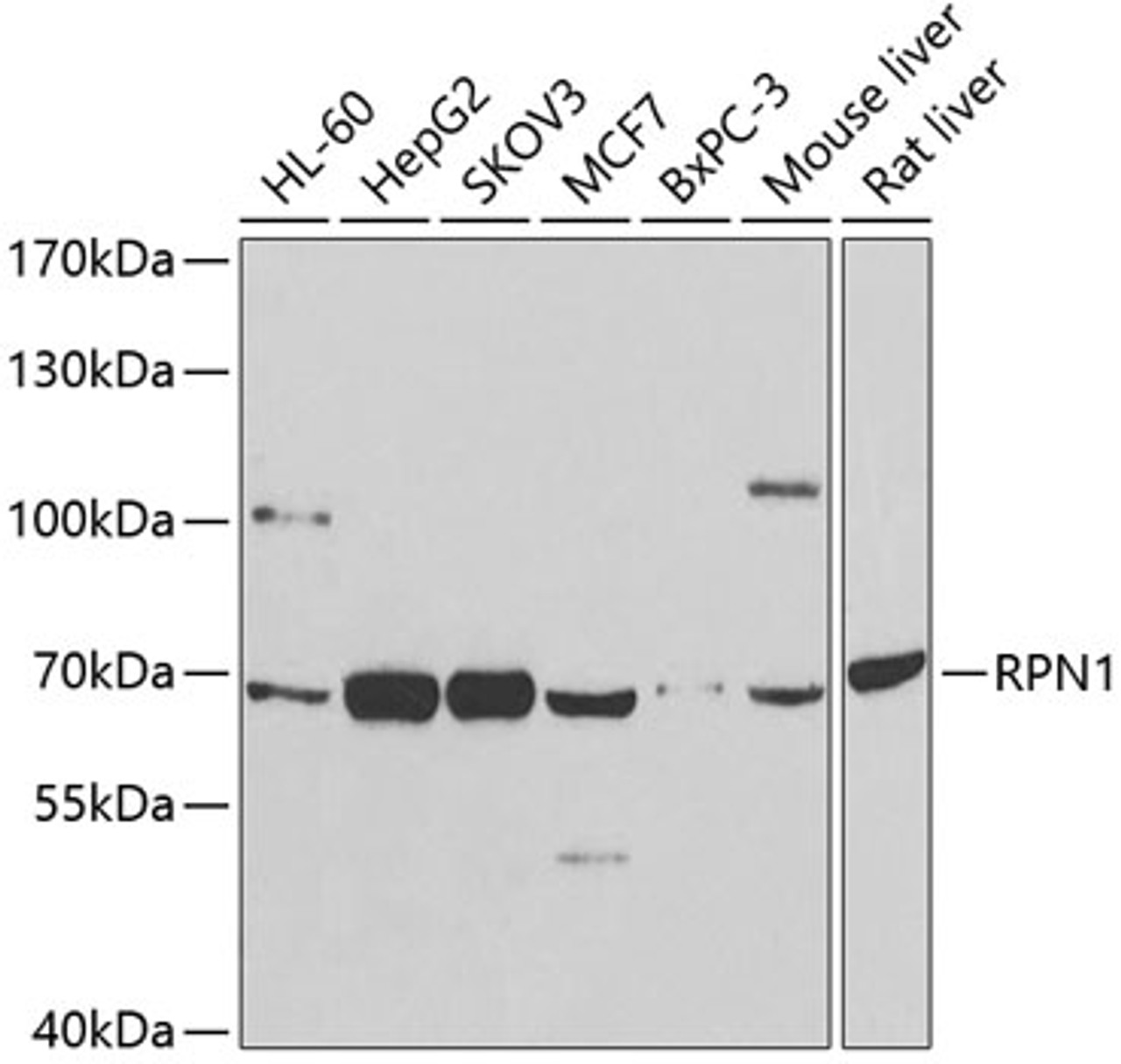 Western blot analysis of extracts of various cell lines, using RPN1 antibody (14-462) at 1:1000 dilution.<br/>Secondary antibody: HRP Goat Anti-Rabbit IgG (H+L) at 1:10000 dilution.<br/>Lysates/proteins: 25ug per lane.<br/>Blocking buffer: 3% nonfat dry milk in TBST.<br/>Detection: ECL Basic Kit.<br/>Exposure time: 90s.