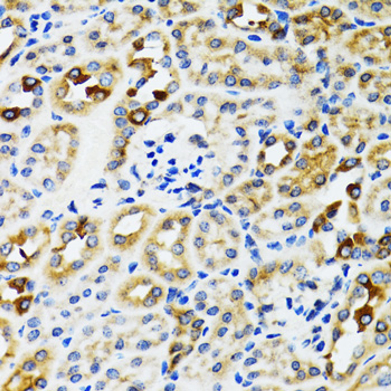 Immunohistochemistry of paraffin-embedded rat kidney using RPN1 antibody (14-462) at dilution of 1:100 (40x lens) .