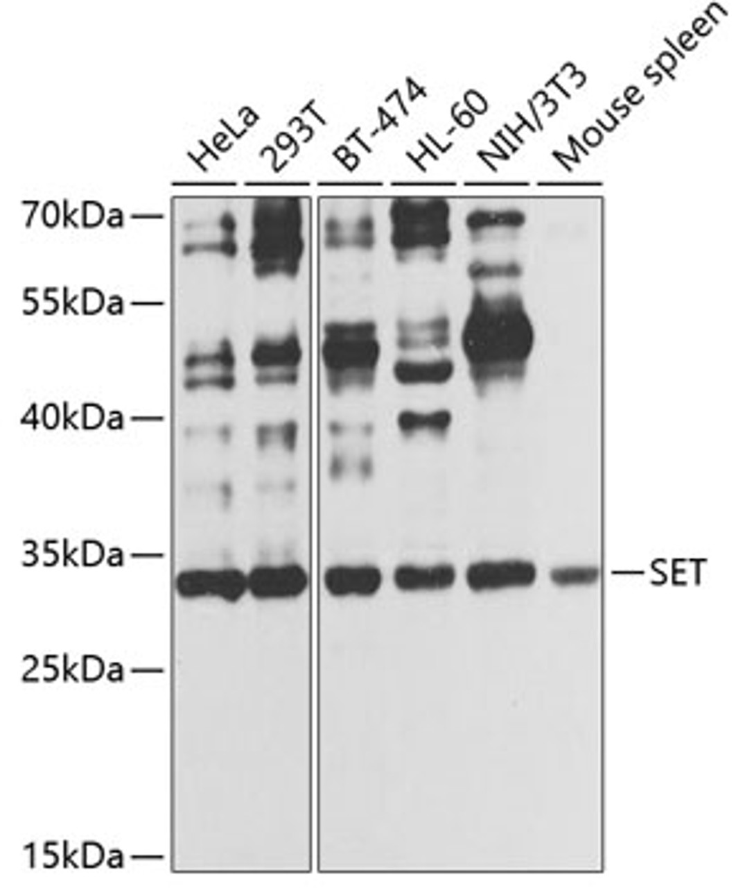 Western blot analysis of extracts of various cell lines, using SET antibody (14-466) at 1:1000 dilution.<br/>Secondary antibody: HRP Goat Anti-Rabbit IgG (H+L) at 1:10000 dilution.<br/>Lysates/proteins: 25ug per lane.<br/>Blocking buffer: 3% nonfat dry milk in TBST.<br/>Detection: ECL Basic Kit.<br/>Exposure time: 30s.