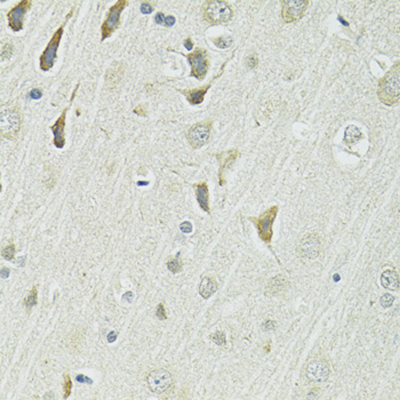 Immunohistochemistry of paraffin-embedded rat brain using SLC1A4 antibody (14-469) at dilution of 1:100 (40x lens) .