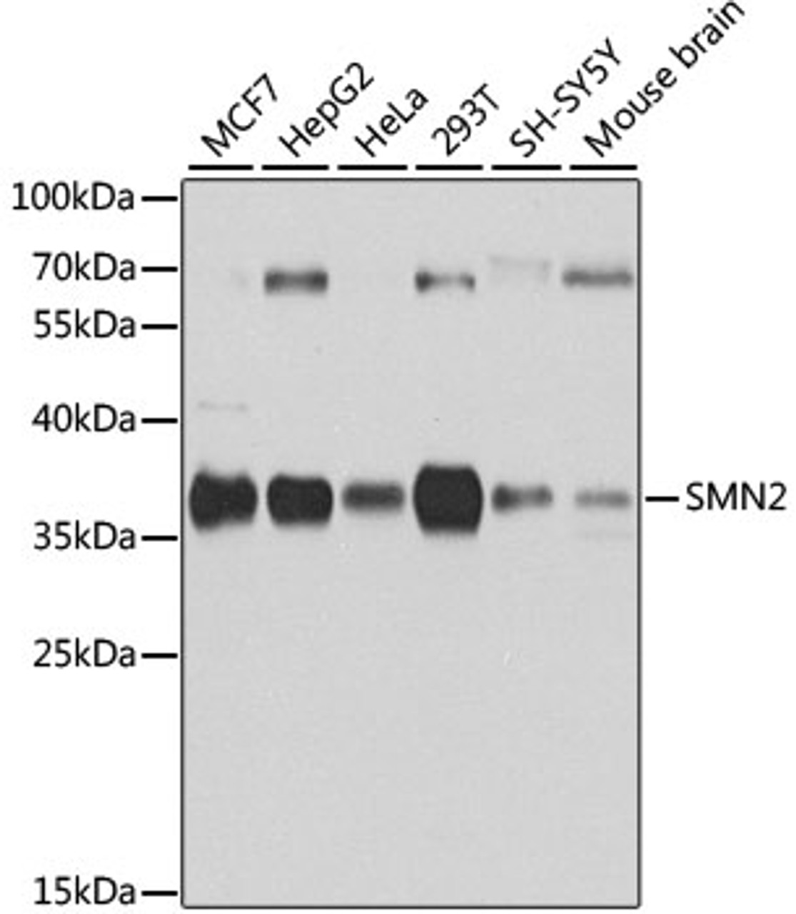 Western blot analysis of extracts of various cell lines, using SMN2 antibody (14-470) at 1:1000 dilution.<br/>Secondary antibody: HRP Goat Anti-Rabbit IgG (H+L) at 1:10000 dilution.<br/>Lysates/proteins: 25ug per lane.<br/>Blocking buffer: 3% nonfat dry milk in TBST.<br/>Detection: ECL Basic Kit.<br/>Exposure time: 10s.