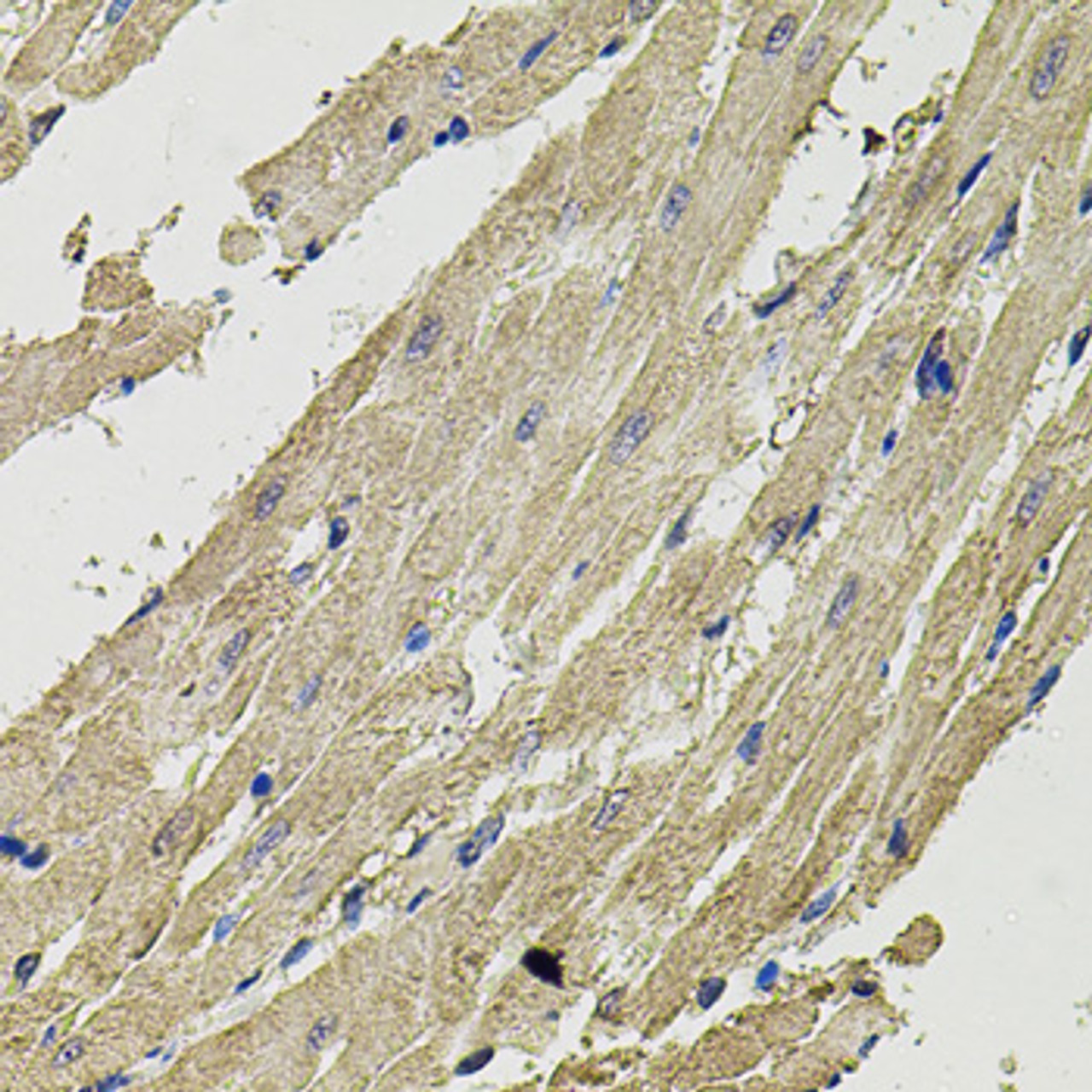 Immunohistochemistry of paraffin-embedded rat heart using SMN2 antibody (14-470) (40x lens) .