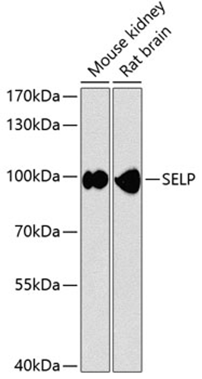 Western blot analysis of extracts of various cell lines, using SELP antibody (14-473) at 1:1000 dilution.<br/>Secondary antibody: HRP Goat Anti-Rabbit IgG (H+L) at 1:10000 dilution.<br/>Lysates/proteins: 25ug per lane.<br/>Blocking buffer: 3% nonfat dry milk in TBST.<br/>Detection: ECL Enhanced Kit.<br/>Exposure time: 5s.
