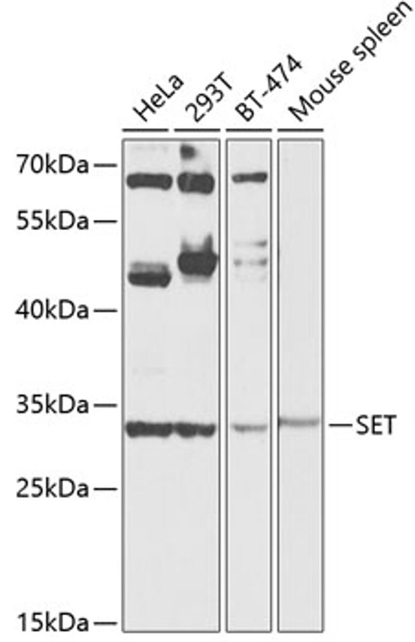 Western blot analysis of extracts of various cell lines, using SET antibody (14-474) at 1:1000 dilution.<br/>Secondary antibody: HRP Goat Anti-Rabbit IgG (H+L) at 1:10000 dilution.<br/>Lysates/proteins: 25ug per lane.<br/>Blocking buffer: 3% nonfat dry milk in TBST.<br/>Detection: ECL Basic Kit.<br/>Exposure time: 60s.