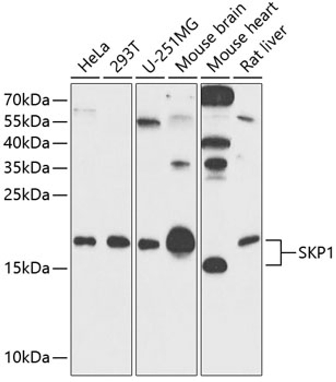 Western blot analysis of extracts of various cell lines, using SKP1 antibody (14-478) at 1:500 dilution.<br/>Secondary antibody: HRP Goat Anti-Rabbit IgG (H+L) at 1:10000 dilution.<br/>Lysates/proteins: 25ug per lane.<br/>Blocking buffer: 3% nonfat dry milk in TBST.<br/>Detection: ECL Basic Kit.<br/>Exposure time: 90s.