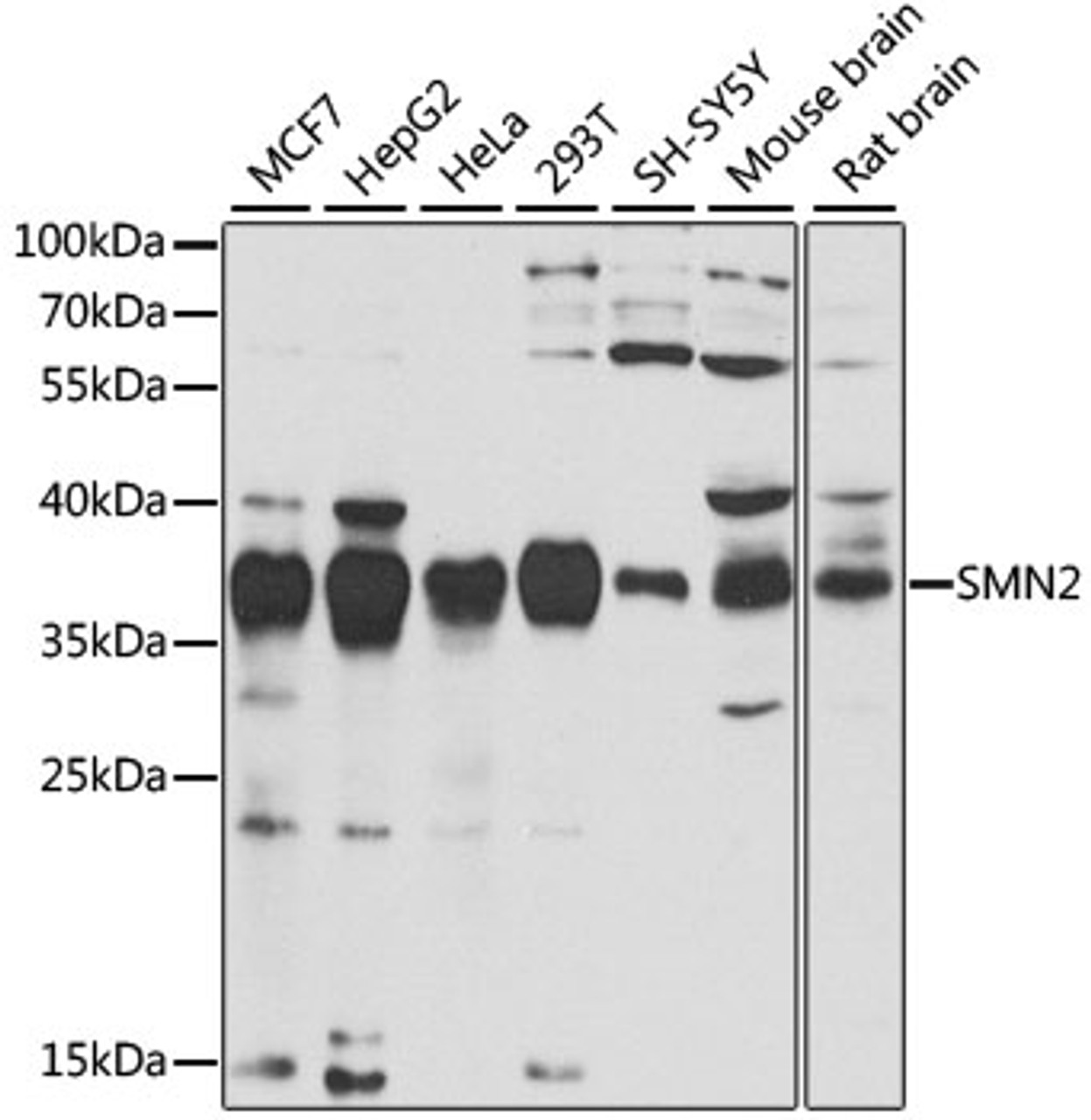 Western blot analysis of extracts of various cell lines, using SMN2 antibody (14-479) at 1:1000 dilution.<br/>Secondary antibody: HRP Goat Anti-Rabbit IgG (H+L) at 1:10000 dilution.<br/>Lysates/proteins: 25ug per lane.<br/>Blocking buffer: 3% nonfat dry milk in TBST.<br/>Detection: ECL Basic Kit.<br/>Exposure time: 30s.